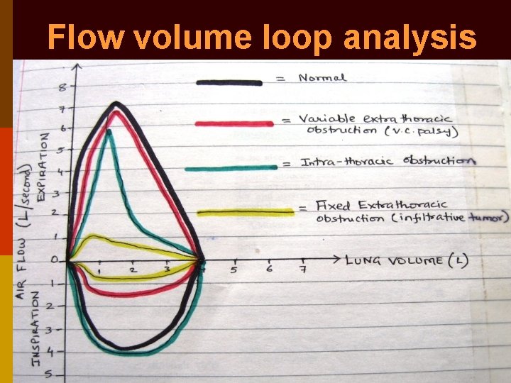 Flow volume loop analysis 