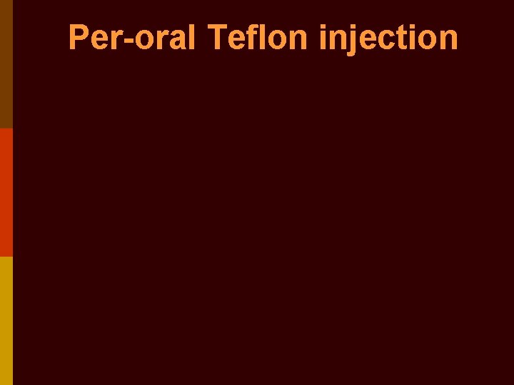 Per-oral Teflon injection 