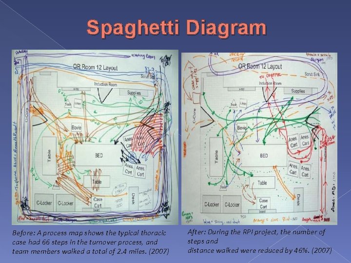 Spaghetti Diagram Before: A process map shows the typical thoracic case had 66 steps