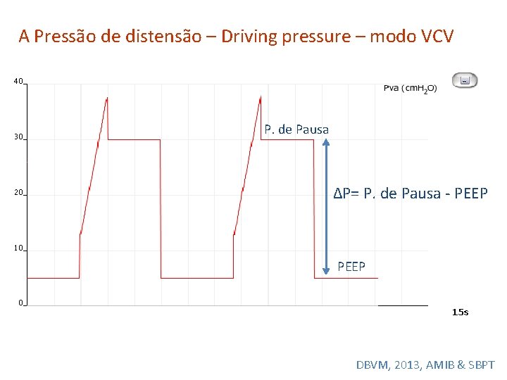 A Pressão de distensão – Driving pressure – modo VCV P. de Pausa ΔP=