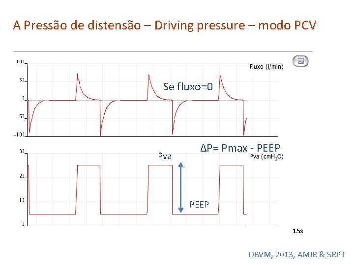 A Pressão de distensão – Driving pressure – modo PCV Se fluxo=0 Pva ΔP=