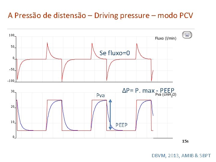 A Pressão de distensão – Driving pressure – modo PCV Se fluxo=0 Pva ΔP=