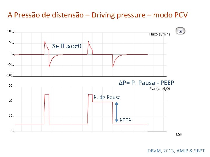 A Pressão de distensão – Driving pressure – modo PCV Se fluxo≠ 0 ΔP=