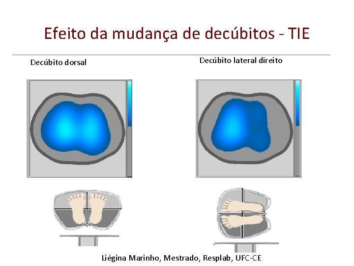 Efeito da mudança de decúbitos - TIE Decúbito dorsal Decúbito lateral direito Liégina Marinho,