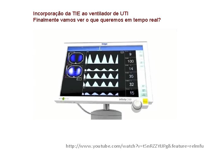 Incorporação da TIE ao ventilador de UTI Finalmente vamos ver o queremos em tempo