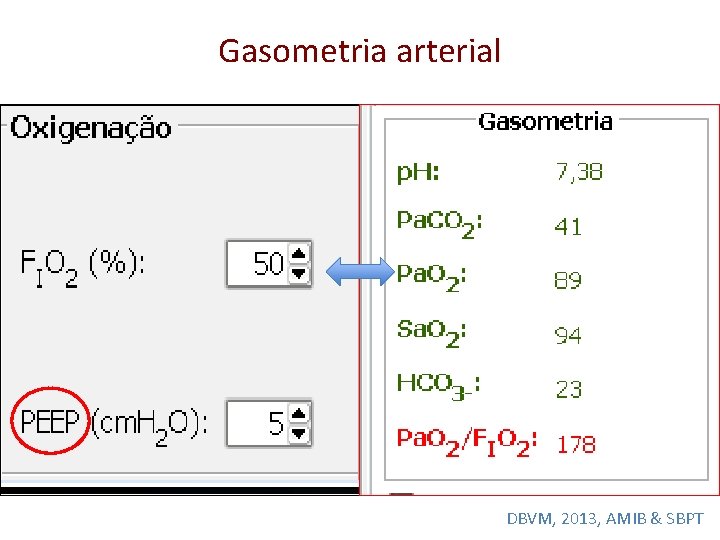 Gasometria arterial DBVM, 2013, AMIB & SBPT 