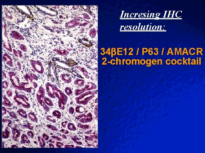 Slide 51 © 2003 By Default! Incresing IHC resolution: 34 E 12 / P Slide 51 © 2003 By Default! Incresing IHC resolution: 34 E 12 / P