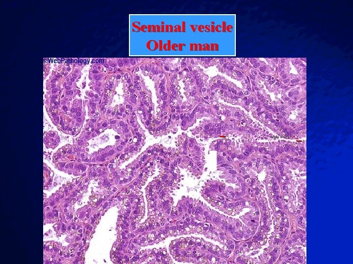 Slide 87 © 2003 By Default! Seminal vesicle Older man A Free sample background Slide 87 © 2003 By Default! Seminal vesicle Older man A Free sample background