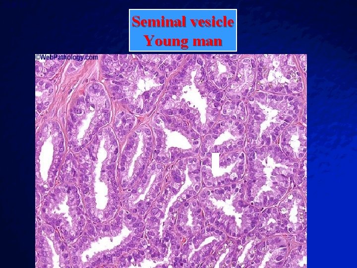 Slide 88 © 2003 By Default! Seminal vesicle Young man A Free sample background Slide 88 © 2003 By Default! Seminal vesicle Young man A Free sample background