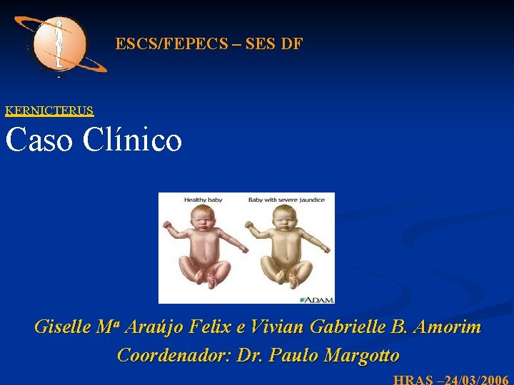 ESCS/FEPECS – SES DF KERNICTERUS Caso Clínico Giselle Ma Araújo Felix e Vivian Gabrielle