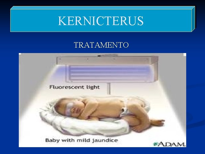 KERNICTERUS TRATAMENTO 