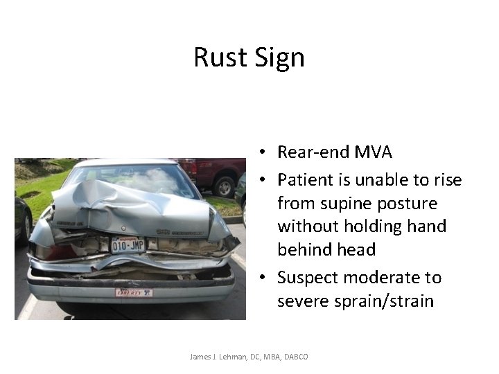 Rust Sign • Rear-end MVA • Patient is unable to rise from supine posture