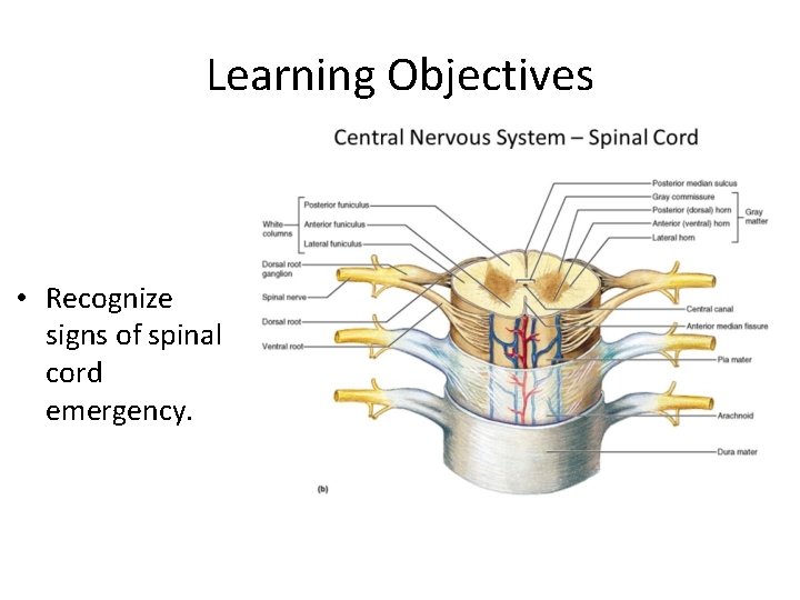 Learning Objectives • Recognize signs of spinal cord emergency. 