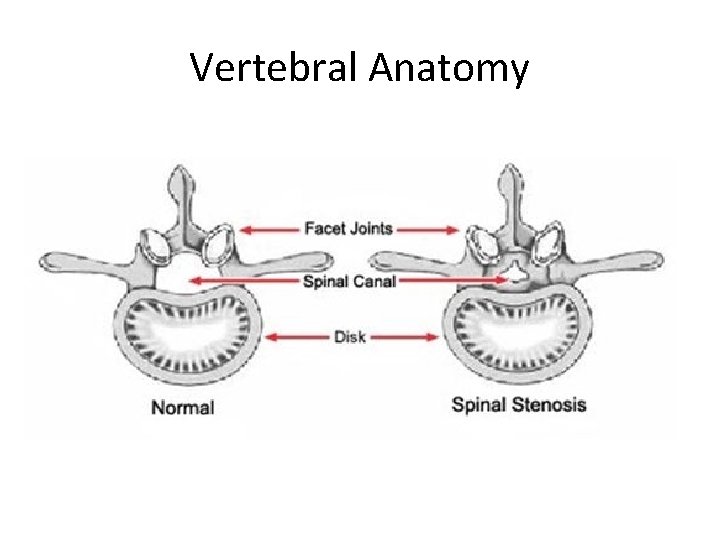 Vertebral Anatomy 