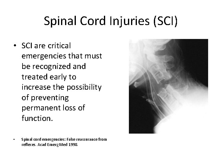 Spinal Cord Injuries (SCI) • SCI are critical emergencies that must be recognized and
