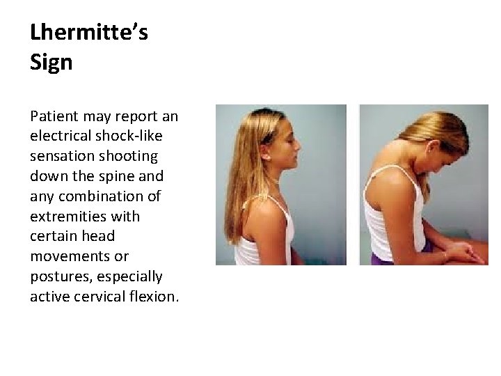 Lhermitte’s Sign Patient may report an electrical shock-like sensation shooting down the spine and