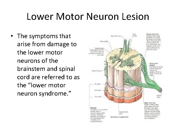 Lower Motor Neuron Lesion • The symptoms that arise from damage to the lower