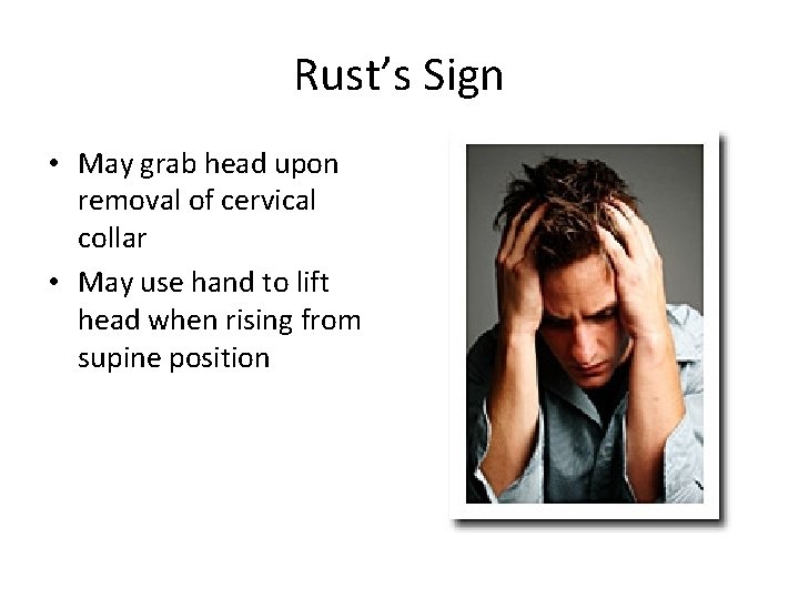 Rust’s Sign • May grab head upon removal of cervical collar • May use