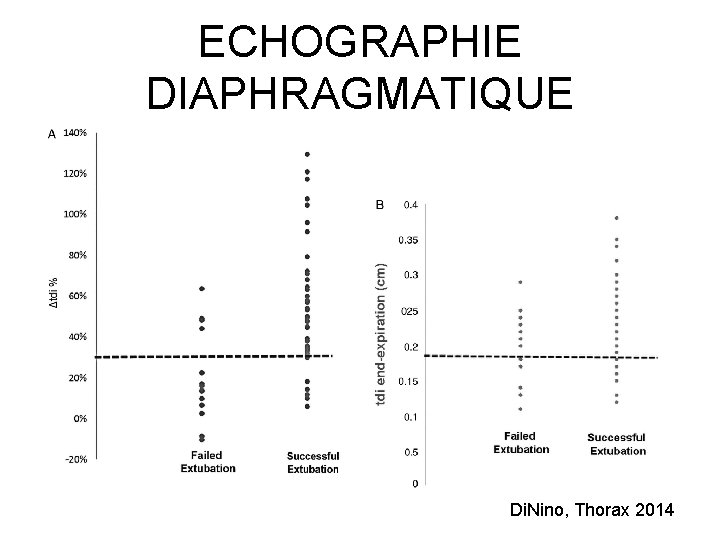 ECHOGRAPHIE DIAPHRAGMATIQUE Di. Nino, Thorax 2014 