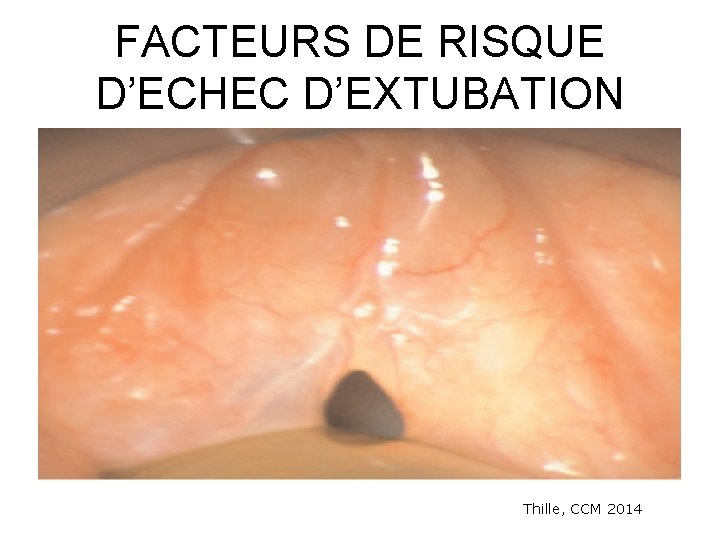 FACTEURS DE RISQUE D’ECHEC D’EXTUBATION Thille, CCM 2014 