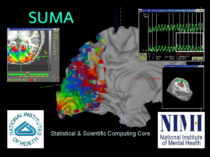 SUMA Statistical & Scientific Computing Core 7/2/2004 SSCC/NIMH 