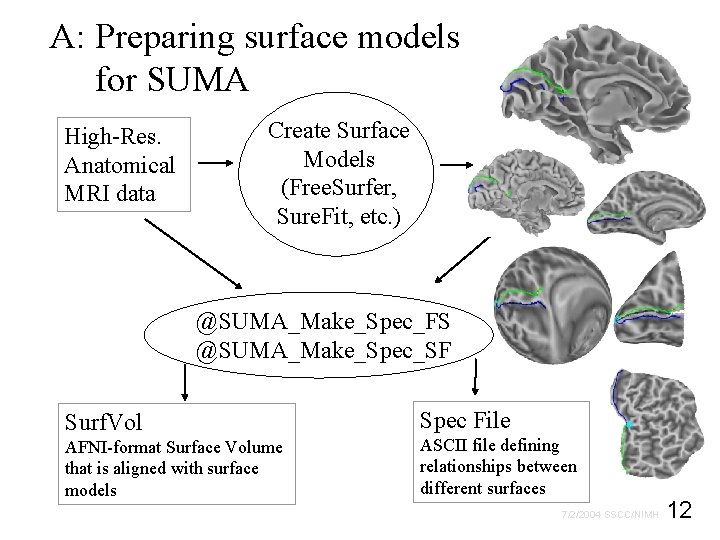 A: Preparing surface models for SUMA High-Res. Anatomical MRI data Create Surface Models (Free.