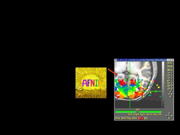  2 7/2/2004 SSCC/NIMH 