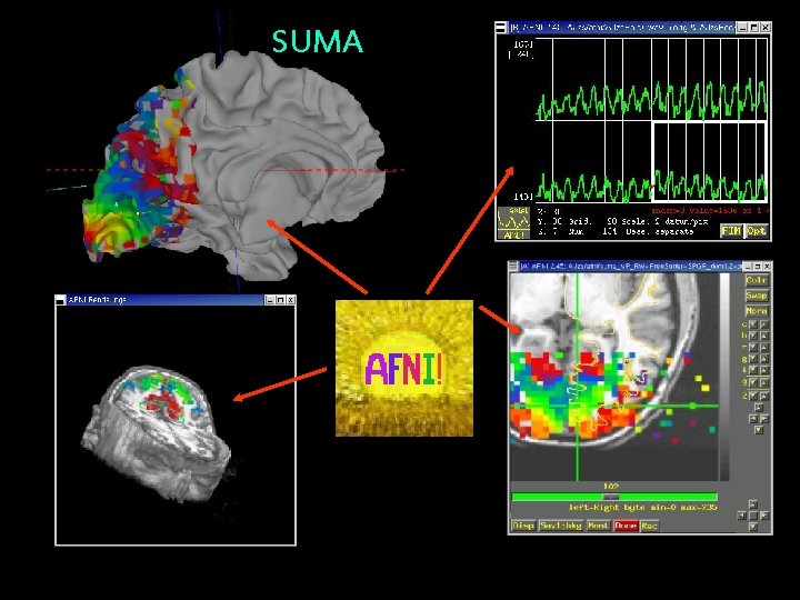 SUMA 5 7/2/2004 SSCC/NIMH 