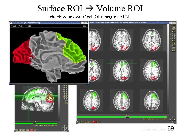 Surface ROI Volume ROI check your own Occ. ROIs+orig in AFNI 69 7/2/2004 SSCC/NIMH