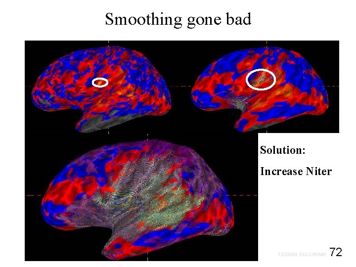 Smoothing gone bad Solution: Increase Niter 72 7/2/2004 SSCC/NIMH 