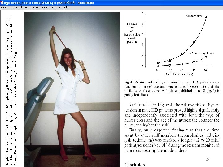 Nephrol Dial Transplant (1999) 14: 861– 862 Nephrology Dialysis Transplantation Preliminary Report White coat