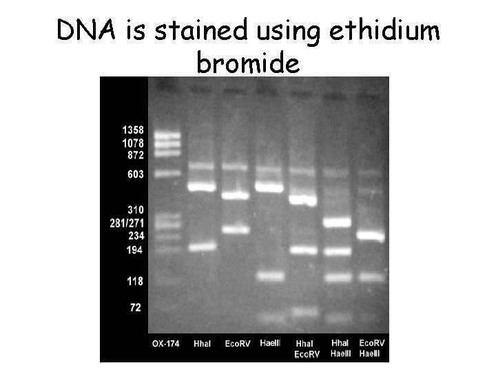 DNA is stained using ethidium bromide 