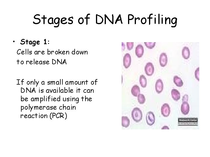 Stages of DNA Profiling • Stage 1: Cells are broken down to release DNA