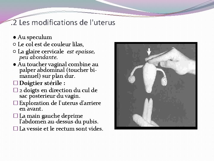 . 2 Les modifications de l'uterus ● Au speculum ○ Le col est de