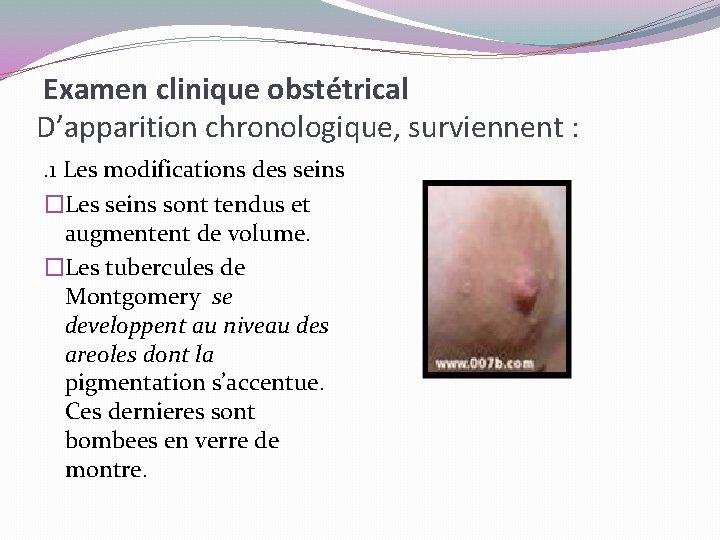 Examen clinique obstétrical D’apparition chronologique, surviennent : . 1 Les modifications des seins �Les