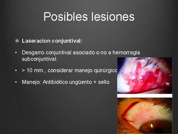 Posibles lesiones Laseracion conjuntival: • Desgarro conjuntival asociado o no a hemorragia subconjuntival. •