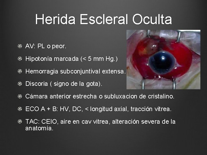 Herida Escleral Oculta AV: PL o peor. Hipotonía marcada (< 5 mm Hg. )