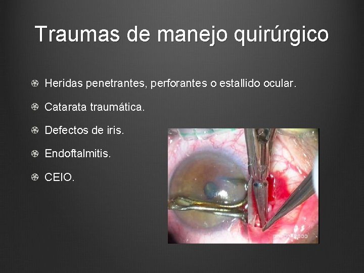 Traumas de manejo quirúrgico Heridas penetrantes, perforantes o estallido ocular. Catarata traumática. Defectos de