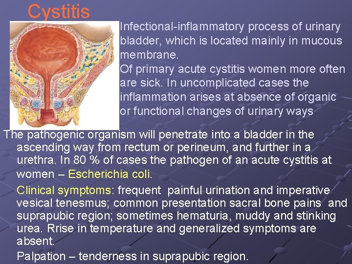 Cystitis Infectional-inflammatory process of urinary bladder, which is located mainly in mucous membrane. Of