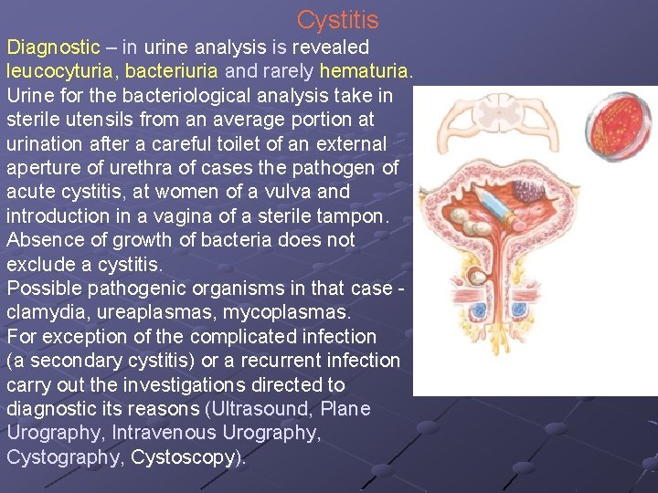 Cystitis Diagnostic – in urine analysis is revealed leucocyturia, bacteriuria and rarely hematuria. Urine