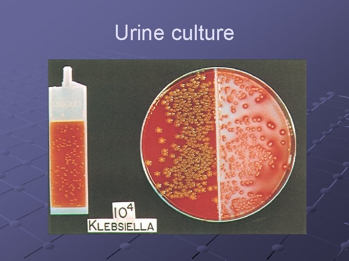Urine culture 