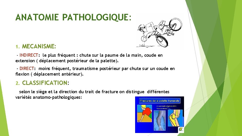 ANATOMIE PATHOLOGIQUE: 1. MECANISME: - INDIRECT: le plus fréquent : chute sur la paume