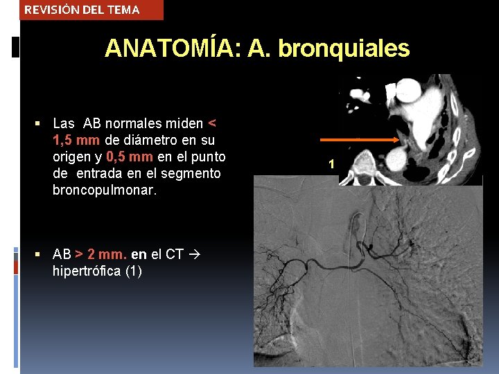 REVISIÓN DEL TEMA ANATOMÍA: A. bronquiales Las AB normales miden < 1, 5 mm