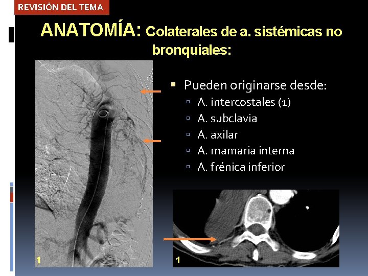 REVISIÓN DEL TEMA ANATOMÍA: Colaterales de a. sistémicas no bronquiales: Pueden originarse desde: 1
