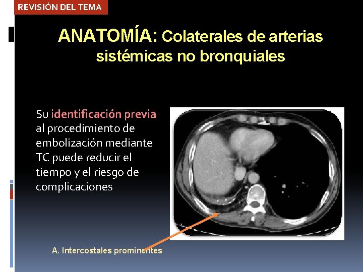 REVISIÓN DEL TEMA ANATOMÍA: Colaterales de arterias sistémicas no bronquiales Su identificación previa al