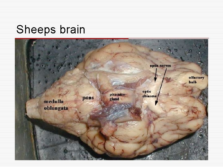 Sheeps brain 