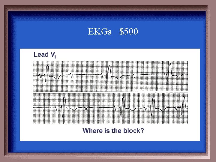 EKGs $500 