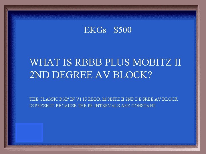 EKGs $500 WHAT IS RBBB PLUS MOBITZ II 2 ND DEGREE AV BLOCK? THE