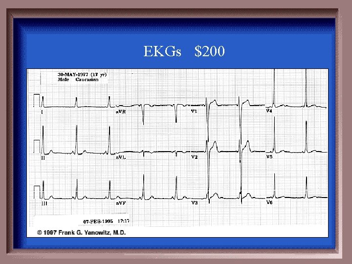 EKGs $200 