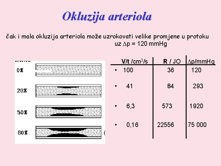 Okluzija arteriola čak i mala okluzija arteriola može uzrokovati velike promjene u protoku uz